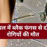 हिमाचल में ब्लैक फंगस से दो और रोगियों की मौत, तीन सप्ताह से थे उपचाराधीन…