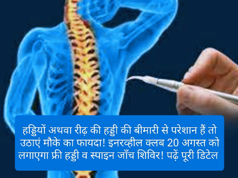 Paonta Sahib: हड्डियों अथवा रीढ़ की हड्डी की बीमारी से परेशान हैं तो उठाएं मौके का फायदा! इनरव्हील क्लब 20 अगस्त को लगाएगा फ्री हड्डी व स्पाइन जाँच शिविर! पढ़ें पूरी डिटेल