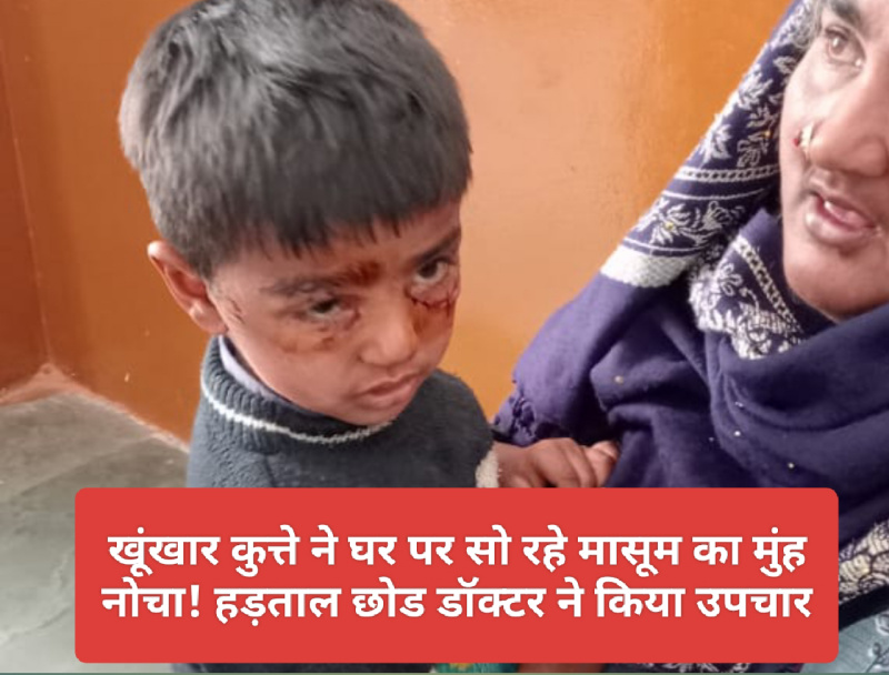 Paonta Sahib: खूंखार कुत्ते ने घर पर सो रहे मासूम का मुंह नोचा! हड़ताल छोड डॉक्टर ने किया उपचार