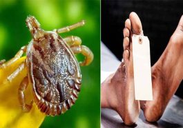 Scrub Typhus: हिमाचल में जानलेवा हुआ स्क्रब टायफस! 17 और 25 वर्षीय दो युवतियों की मौत