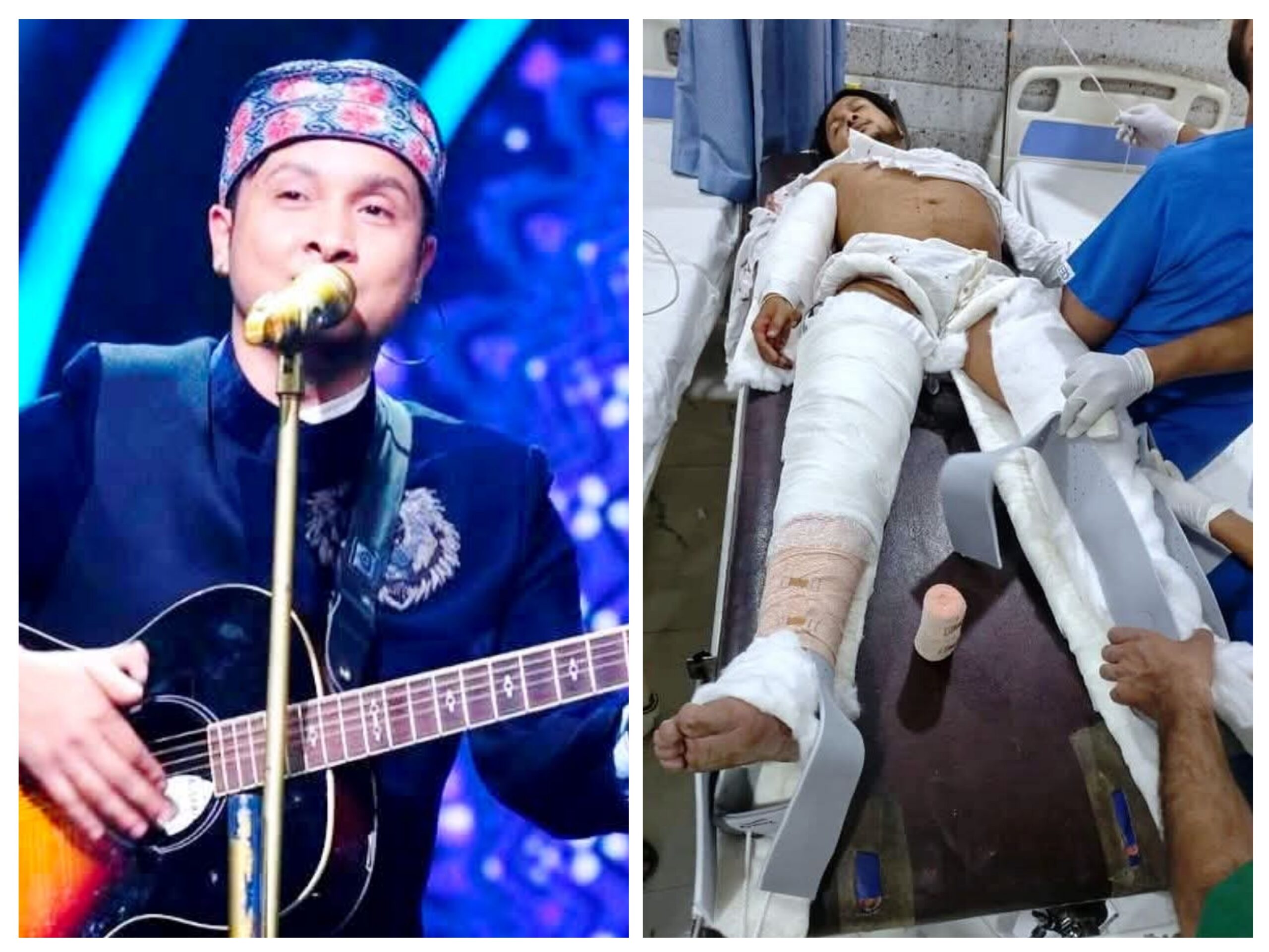 इंडियन आइडल विजेता पवनदीप राजन सड़क हादसे में घायल, उत्तराखंड में सलामती की दुआएं….