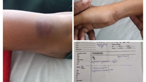 अम्बोया (सिरमौर) : 9वीं के छात्र की शिक्षक ने की बेरहमी से पिटाई, पिता ने की सख्त कार्रवाई की मांग