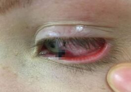 हिमाचल में दुखद हादसा: स्कूल से लौटते 8 वर्षीय बच्चे की आँख में घुसी पेंसिल! हालत गंभीर