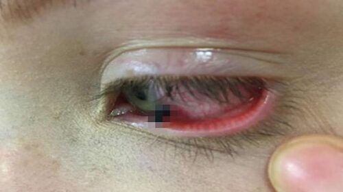 हिमाचल में दुखद हादसा: स्कूल से लौटते 8 वर्षीय बच्चे की आँख में घुसी पेंसिल! हालत गंभीर हिमाचल में दुखद हादसा: स्कूल से लौटते 8 वर्षीय बच्चे की आँख में घुसी पेंसिल! हालत गंभीर