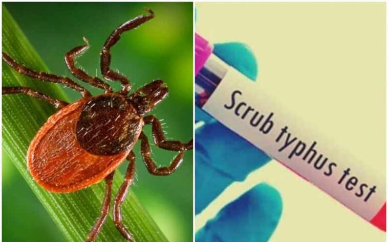 HP News: सिविल अस्पतालों, सीएचसी और पीएचसी में भी अब स्क्रब टायफस सहित टाइफाइड के टेस्ट होंगे निःशुल्क HP News: सिविल अस्पतालों, सीएचसी और पीएचसी में भी अब स्क्रब टायफस सहित टाइफाइड के टेस्ट होंगे निःशुल्क