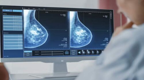 Himachal Latest News: अब 500 रुपये में होगी मैमोग्राफी जांच! मरीजों को बाहरी अस्पतालों में जाने की नहीं पड़ेगी जरुरत Himachal Latest News: अब 500 रुपये में होगी मैमोग्राफी जांच! मरीजों को बाहरी अस्पतालों में जाने की नहीं पड़ेगी जरुरत