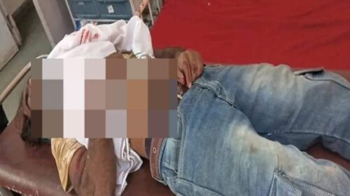 Accident In Himachal: फ्लाईओवर के डिवाइडर से टकराई स्कूटी! युवक ने गवाई जान Accident In Himachal: फ्लाईओवर के डिवाइडर से टकराई स्कूटी! युवक ने गवाई जान