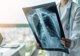 HP News: ऑनलाइन पर्ची सिस्टम के बाद अब एक्स-रे डिजिटलीकरण की सुविधा शुरू! मोबाइल फोन पर उपलब्ध होगी रिपोर्ट