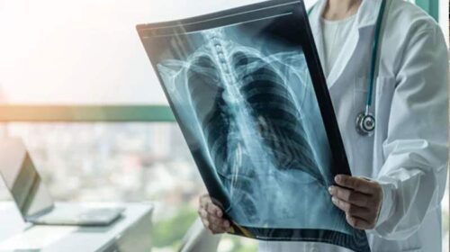 HP News: ऑनलाइन पर्ची सिस्टम के बाद अब एक्स-रे डिजिटलीकरण की सुविधा शुरू! मोबाइल फोन पर उपलब्ध होगी रिपोर्ट
