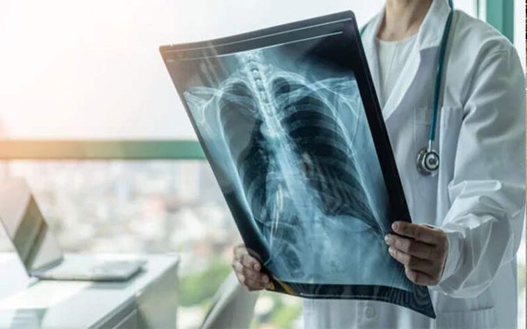 HP News: ऑनलाइन पर्ची सिस्टम के बाद अब एक्स-रे डिजिटलीकरण की सुविधा शुरू! मोबाइल फोन पर उपलब्ध होगी रिपोर्ट HP News: ऑनलाइन पर्ची सिस्टम के बाद अब एक्स-रे डिजिटलीकरण की सुविधा शुरू! मोबाइल फोन पर उपलब्ध होगी रिपोर्ट