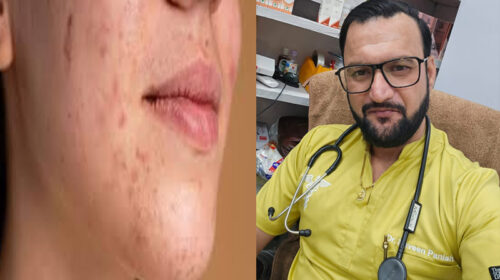 Paonta Sahib: पांवटा साहिब में डॉ. नवीन पनिष्टा का होम्योपैथिक क्लिनिक! स्किन प्रॉब्लम्स के लिए भरोसेमंद इलाज Paonta Sahib: पांवटा साहिब में डॉ. नवीन पनिष्टा का होम्योपैथिक क्लिनिक! स्किन प्रॉब्लम्स के लिए भरोसेमंद इलाज