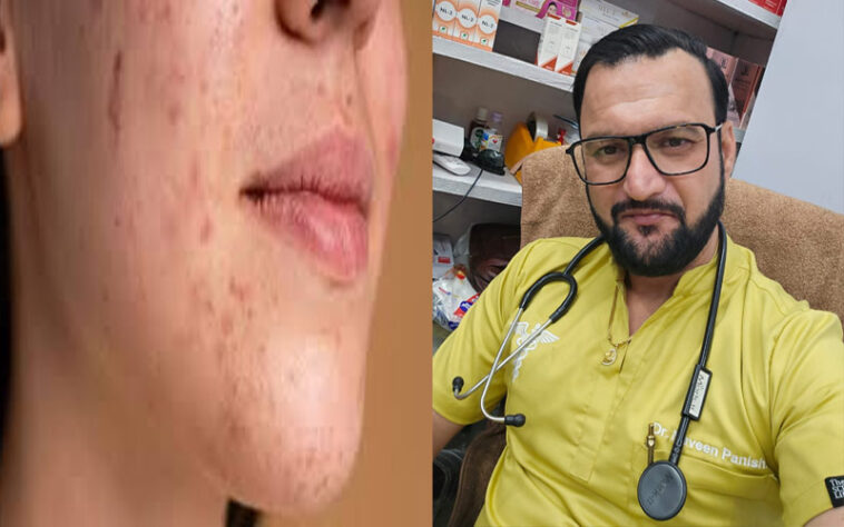 Paonta Sahib: पांवटा साहिब में डॉ. नवीन पनिष्टा का होम्योपैथिक क्लिनिक! स्किन प्रॉब्लम्स के लिए भरोसेमंद इलाज Paonta Sahib: पांवटा साहिब में डॉ. नवीन पनिष्टा का होम्योपैथिक क्लिनिक! स्किन प्रॉब्लम्स के लिए भरोसेमंद इलाज