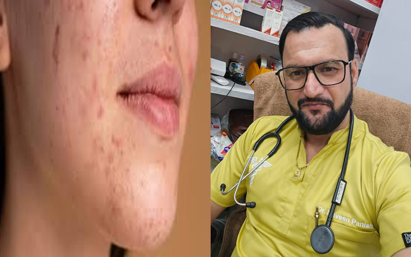 Paonta Sahib: पांवटा साहिब में डॉ. नवीन पनिष्टा का होम्योपैथिक क्लिनिक! स्किन प्रॉब्लम्स के लिए भरोसेमंद इलाज