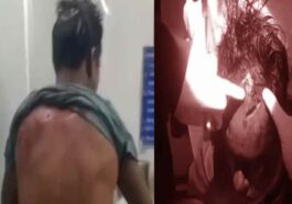 Bear attack: काम के लिए निकले व्यक्ति पर भालू ने किया हमला! गंभीर घायल, वन विभाग ने बढ़ाई गश्त