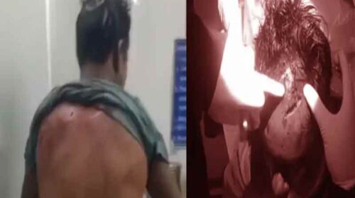 Bear attack: काम के लिए निकले व्यक्ति पर भालू ने किया हमला! गंभीर घायल, वन विभाग ने बढ़ाई गश्त