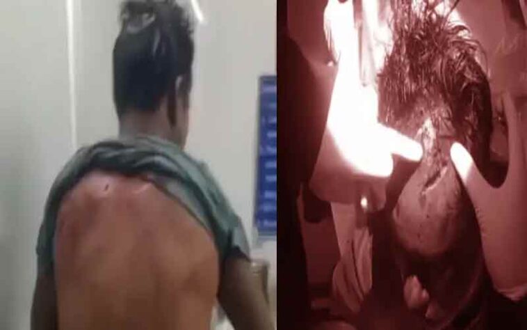 Bear attack: काम के लिए निकले व्यक्ति पर भालू ने किया हमला! गंभीर घायल, वन विभाग ने बढ़ाई गश्त