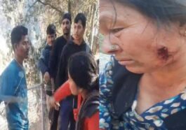 Himachal Crime News: पहले नेपाली ने महिला के छीने आभूषण! फिर दांतों से बुरी तरह काटा, ग्रामीणों ने की धुनाई
