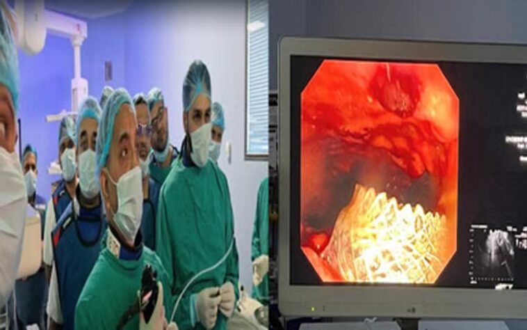 उपलिब्ध: चमियाना अस्पताल के डॉक्टरों का कमाल! EUS सिस्टोगैस्ट्रोस्टोमी का किया उपयोग, मरीजों को बड़ी सुविधा उपलिब्ध: चमियाना अस्पताल के डॉक्टरों का कमाल! EUS सिस्टोगैस्ट्रोस्टोमी का किया उपयोग, मरीजों को बड़ी सुविधा