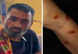 Leopard Attack: घर के पास ही व्यक्ति पर झपट पड़ा तेंदुआ! बुरी तरह जख्मी, ग्रामीणों ने बचाई जान