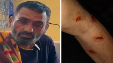 Leopard Attack: घर के पास ही व्यक्ति पर झपट पड़ा तेंदुआ! बुरी तरह जख्मी, ग्रामीणों ने बचाई जान