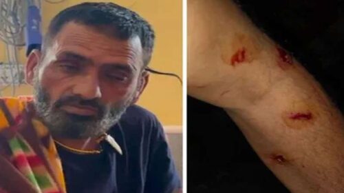 Leopard Attack: घर के पास ही व्यक्ति पर झपट पड़ा तेंदुआ! बुरी तरह जख्मी, ग्रामीणों ने बचाई जान Leopard Attack: घर के पास ही व्यक्ति पर झपट पड़ा तेंदुआ! बुरी तरह जख्मी, ग्रामीणों ने बचाई जान