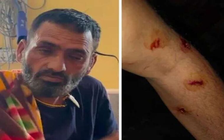 Leopard Attack: घर के पास ही व्यक्ति पर झपट पड़ा तेंदुआ! बुरी तरह जख्मी, ग्रामीणों ने बचाई जान Leopard Attack: घर के पास ही व्यक्ति पर झपट पड़ा तेंदुआ! बुरी तरह जख्मी, ग्रामीणों ने बचाई जान