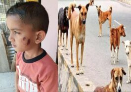 Himachal News Alert: खेत में गेहूं काट रहे थे मां-बाप! तभी कुत्तों के झुंड ने बेटे को किया लहूलुहान, दूर तक घसीटा