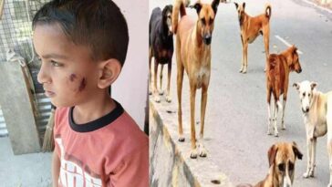 Himachal News Alert: खेत में गेहूं काट रहे थे मां-बाप! तभी कुत्तों के झुंड ने बेटे को किया लहूलुहान, दूर तक घसीटा