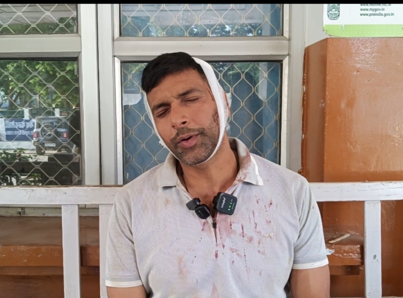 Paonta Sahib: जमीनी विवाद में सेना के जवान पर जा*न*ले*वा हमला, सिर पर गंभीर चोट