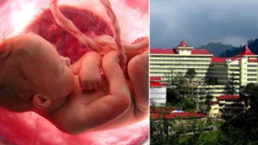 IGMC शिमला में हैरान करने वाला मामला, गर्भ में पल रहे बच्चे के मुंह में मिला दूसरा भ्रूण