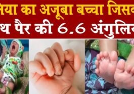 हिमाचल में 24 उंगलियों वाले बच्चे का जन्म, चारों हाथ-पैरों में दिखी अनोखी बनावट