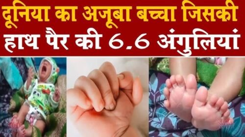 हिमाचल में 24 उंगलियों वाले बच्चे का जन्म, चारों हाथ-पैरों में दिखी अनोखी बनावट हिमाचल में 24 उंगलियों वाले बच्चे का जन्म, चारों हाथ-पैरों में दिखी अनोखी बनावट